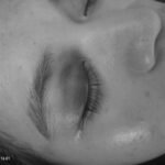 Kondisi Korban SL, mengalami memar di kelopak Mata setelah Dipukuli sang Pacar