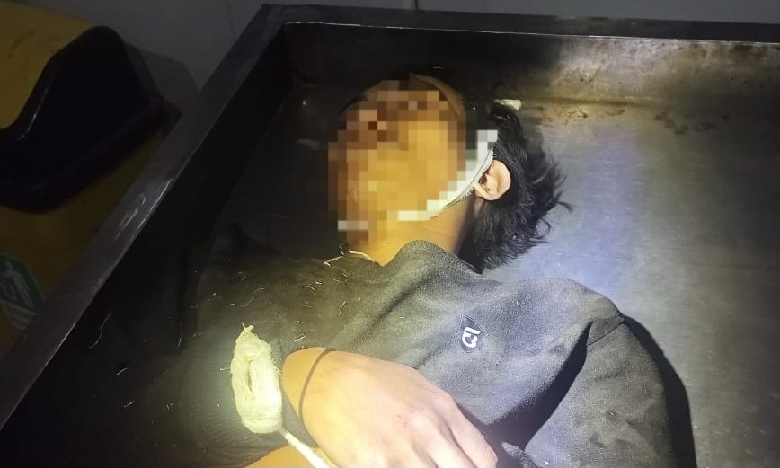 Warga Paguyaman Pantai Tewas Usai Tabrak Truk Tebu